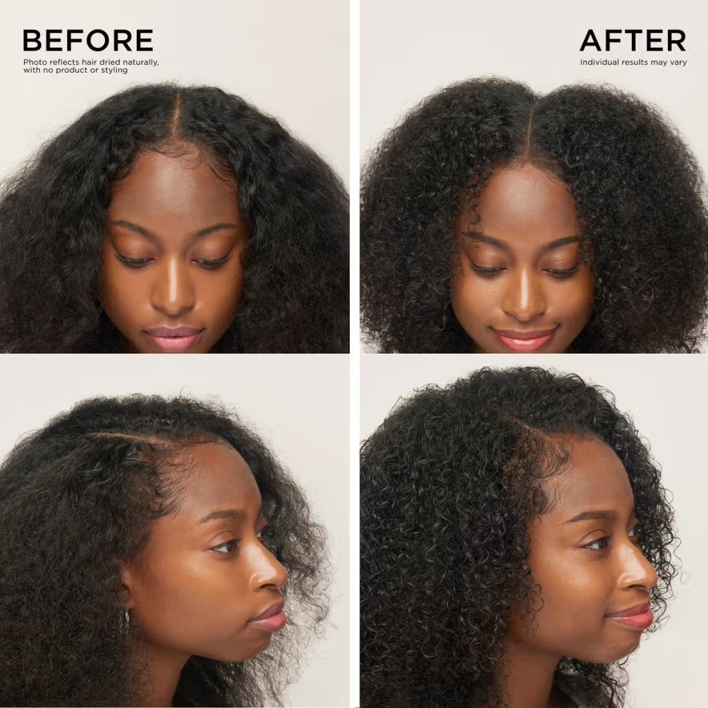 Hair Density Boost Roll-On Scalp Serum