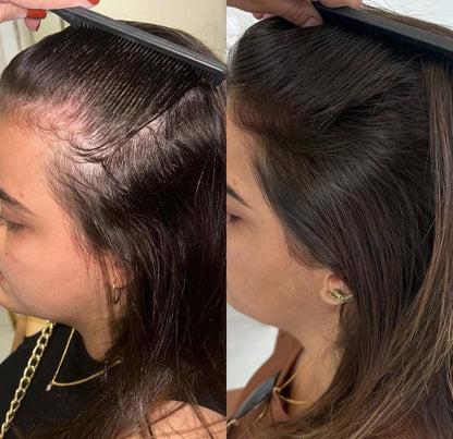 Rosemary Rice Hair Mist Spray