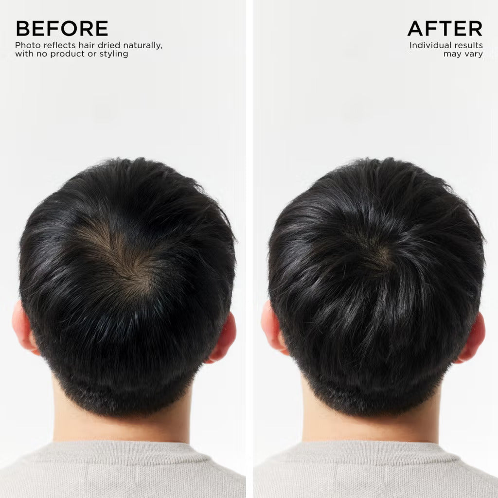 Hair Density Boost Roll-On Scalp Serum