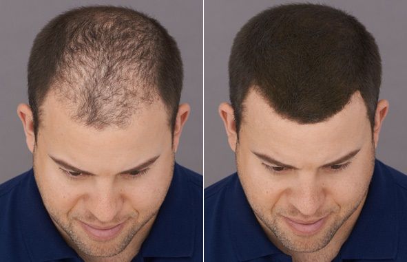 Rosemary Rice Hair Mist Spray